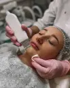 Limpieza facial básica