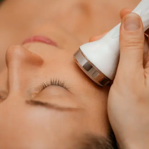 Radiofrecuencia facial